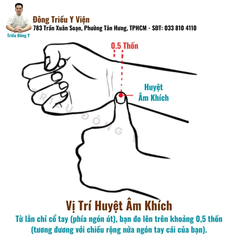 Huyệt Âm Khích 10 Vị trí chính xác của huyệt Âm Khích