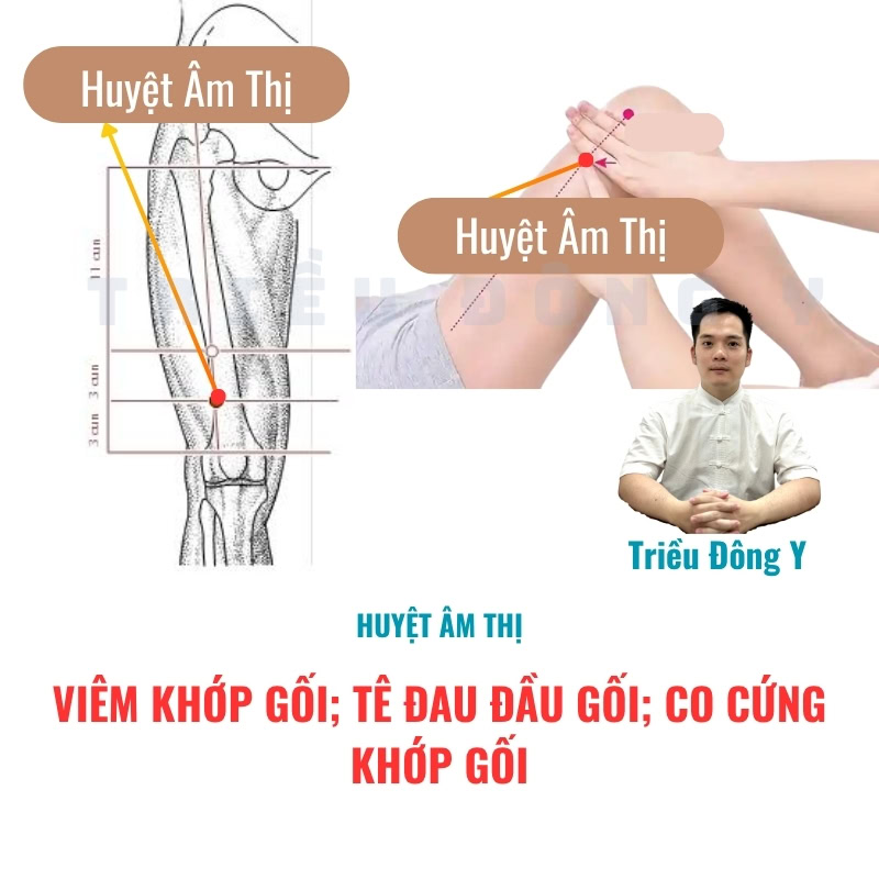 Huyệt Âm Thị 4 Viêm khớp gối; Tê đau đầu gối; Co cứng khớp gối