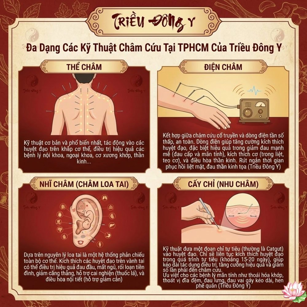 Phương Pháp Châm Cứu Phổ Biến Tại Triều Đông Y