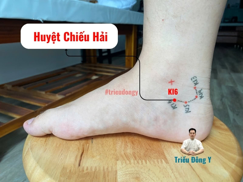 Huyệt Chiếu Hải 5 Xác định vị trí và tác dụng huyệt Chiếu Hải