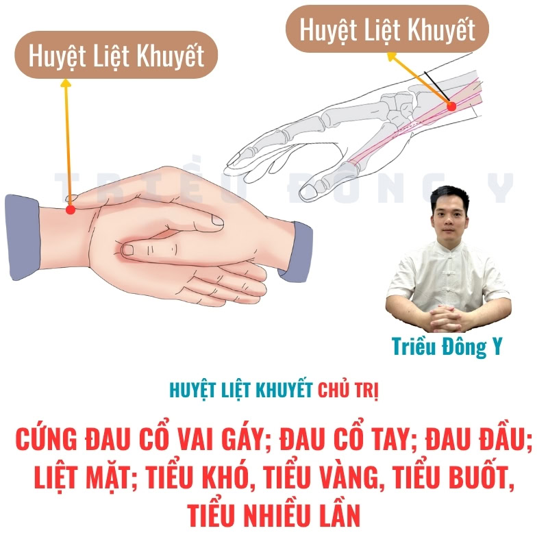 Huyệt Liệt Khuyết 4 Cứng đau cổ vai gáy; Đau cổ tay; Đau đầu; Liệt mặt; Tiểu khó, tiểu vàng, tiểu buốt, tiểu nhiều lần dùng ngay huyệt liệt khuyết