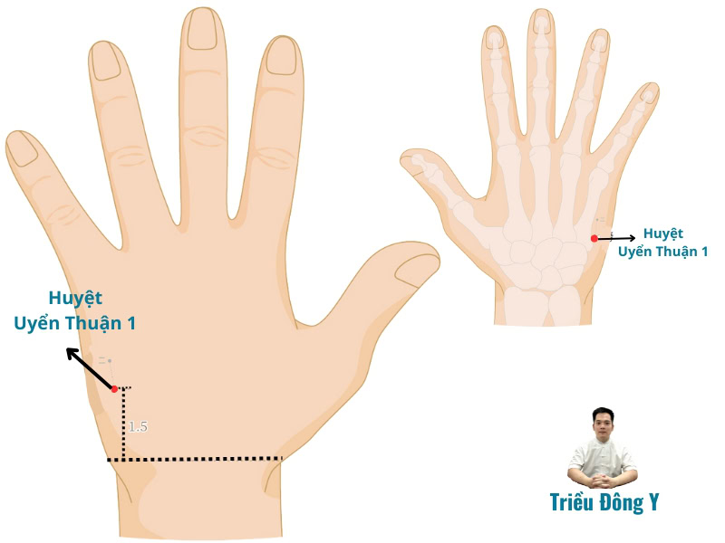 Vị trí huyệt uyển thuận 1