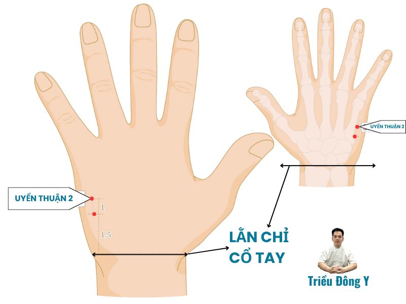 Xác định vị trí chính xác của Huyệt Uyển Thuận 2