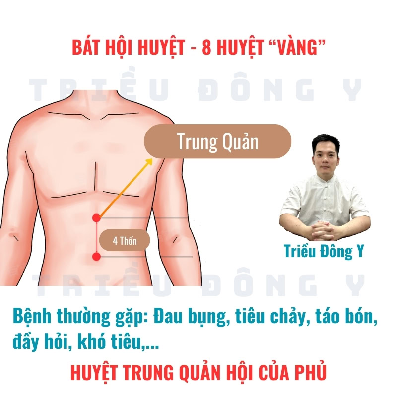 Bát Hội Huyệt 15 Trung Quản (CV12) – Huyệt Hội của Phủ