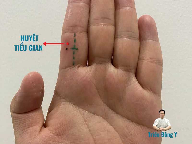 Huyệt Tiểu Gian (11.02 小間穴 - Small Crevice): Phân Tích Chuyên Sâu Về Vị Trí, Công Năng và Ứng Dụng Lâm Sàng Đặc Hiệu Trong Đổng Thị Kỳ Huyệt