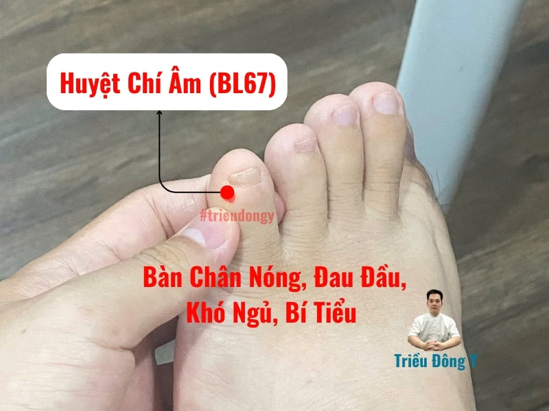 Huyệt Chí Âm 6 Vị trí tác dụng chủ đạo của huyệt Chí Âm