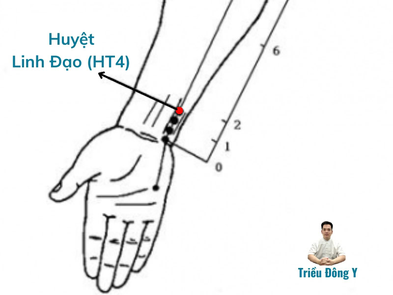 Xác định vị trí Huyệt Linh Đạo (HT4)