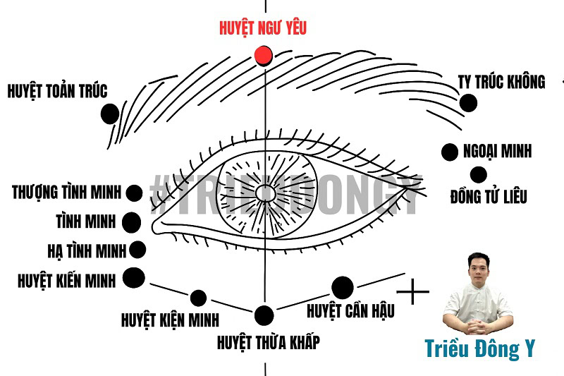 Vị trí huyệt Ngư Yêu