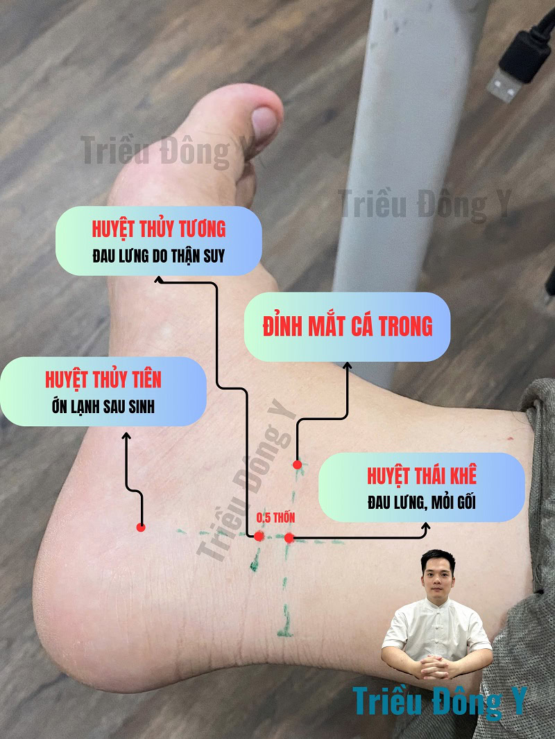 Huyệt Thủy Tương - Thủy Tiên 4 Tác dụng điều trị của huyệt Thủy Tương, Thủy Tiên trong các bệnh lý