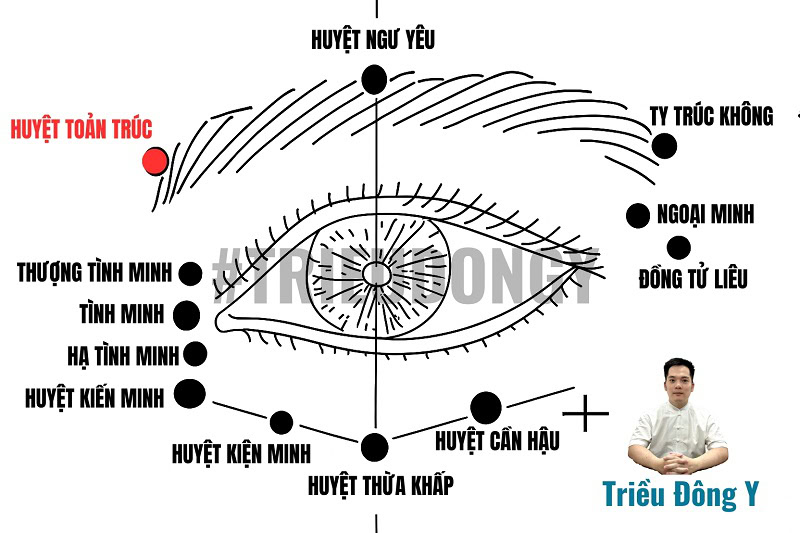 Vị Trí Huyệt Toản Trúc