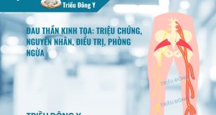 Đau thần kinh tọa (Sciatica pain): Triệu chứng, nguyên nhân, phòng điều trị