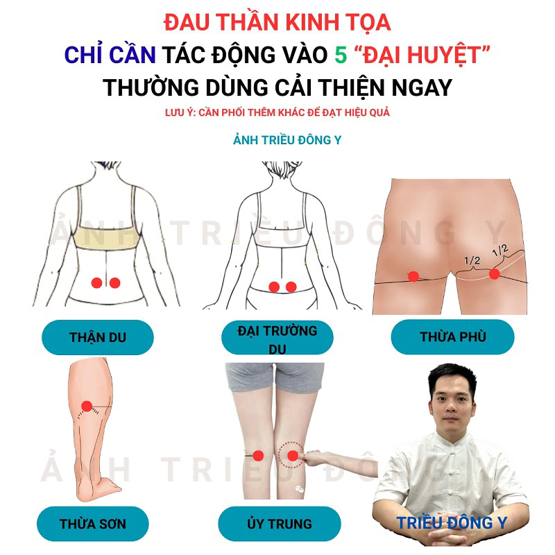 Huyệt đạo dùng trong châm cứu điều trị đau thần kinh tọa