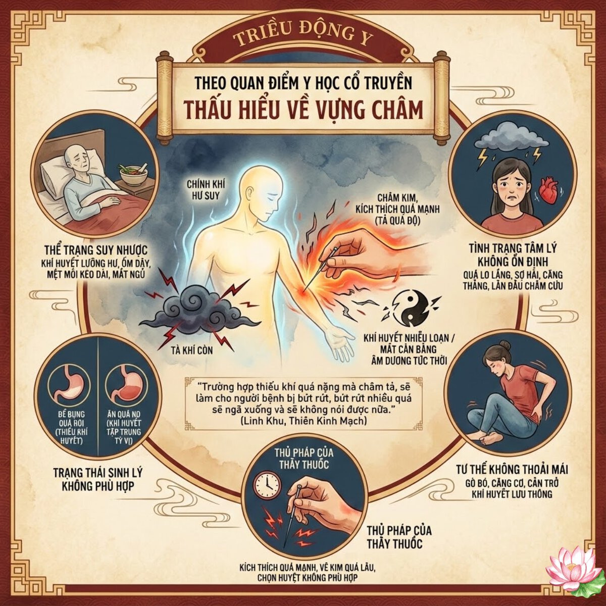 Giải thích cơ chế vựng châm trong đông y để thấu hiểu