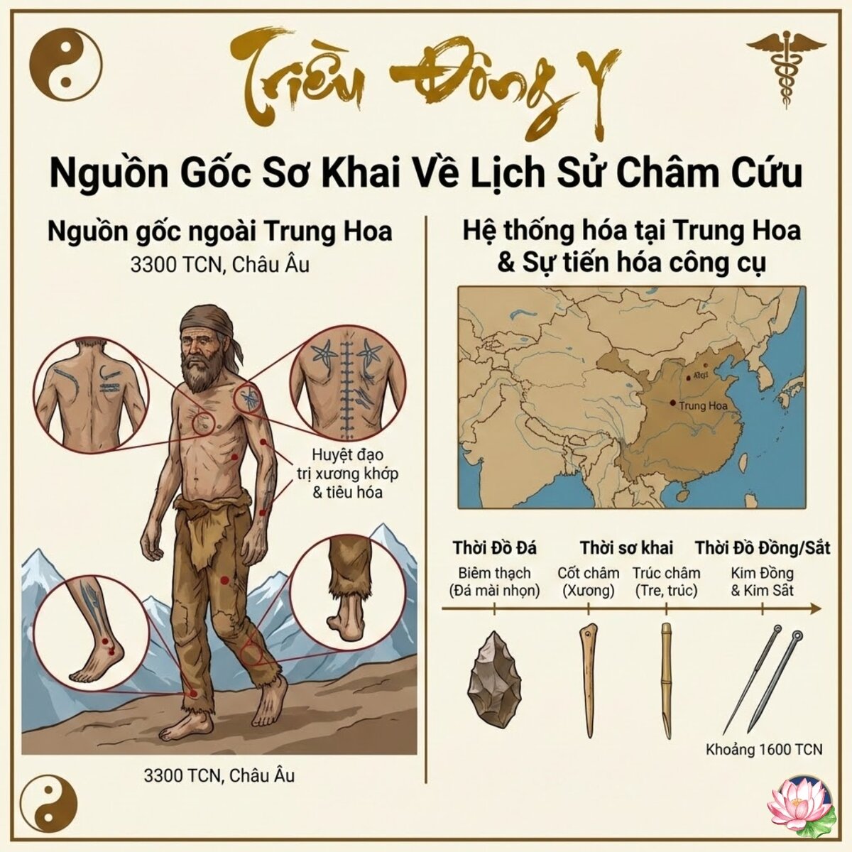 Khám phá nguồn gốc sơ khai của lịch sử châm cứu