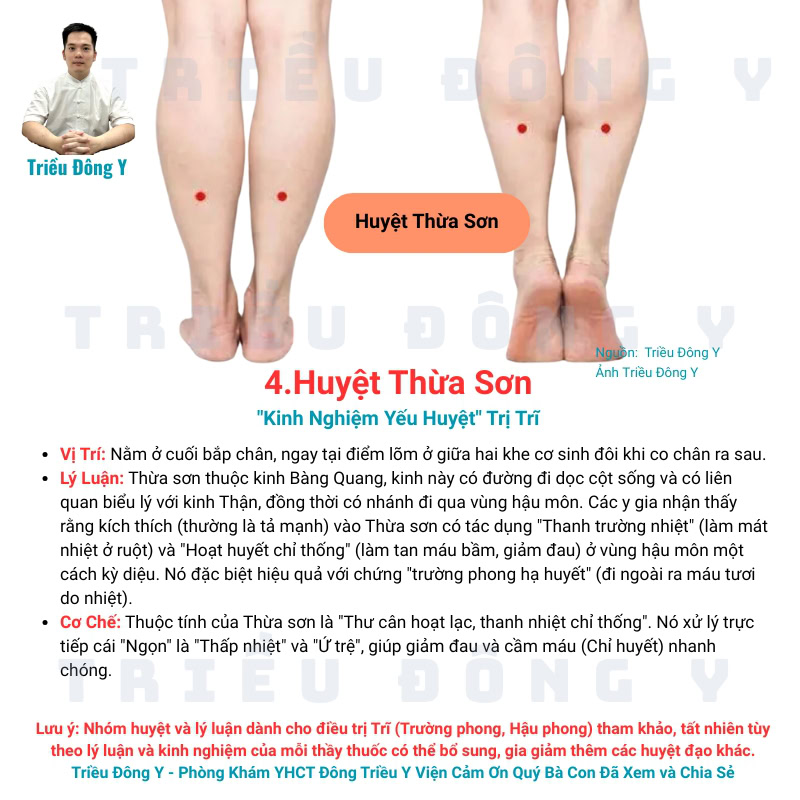 Vì Sao điều trị Trĩ (Trường phong, Hậu phong) dùng bộ huyệt: Trường cường, Bách hội, Thừa sơn, Túc tam lý 10 Huyệt Thừa Sơn Thuộc Bộ Huyệt Điều Trị Trĩ Kinh Điển
