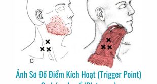 Ảnh sơ đồ Điểm Kích Hoạt (Trigger Point) Cơ bám da cổ (Platysma)