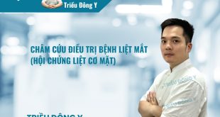 Châm Cứu Điều Trị Bệnh Liệt mắt