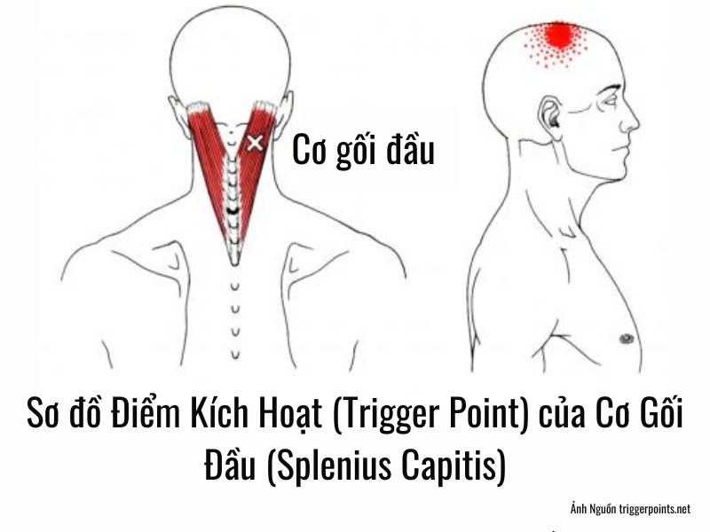 Sơ đồ Điểm Kích Hoạt (Trigger Point) của Cơ Gối Đầu (Splenius Capitis)