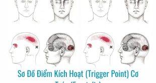 Hình ảnh sơ đồ Điểm Kích Hoạt (Trigger Point) Cơ Trán (Frontalis)