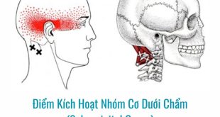 Hình Ảnh Sơ Đồ Điểm Kích Hoạt (Trigger Point) Cơ Dưới Chẩm (Suboccipital Group)