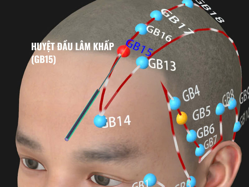 Nguồn Gốc, Vị Trí Huyệt Đầu Lâm Khấp