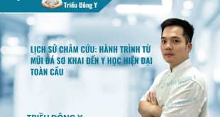 Lịch Sử Châm Cứu: Hành Trình Từ Mũi Đá Sơ Khai Đến Y Học Hiện Đại Toàn Cầu