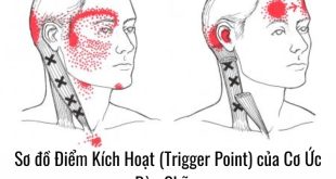Sơ đồ Điểm Kích Hoạt (Trigger Point) của Cơ Ức Đòn Chũm