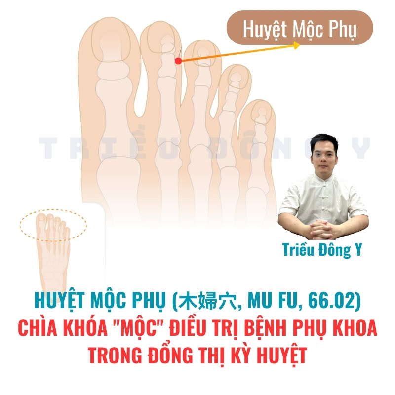 Huyệt Mộc Phụ (66.02): Chìa Khóa "Mộc" Điều Trị Bệnh Phụ Khoa trong Đổng Thị Kỳ Huyệt