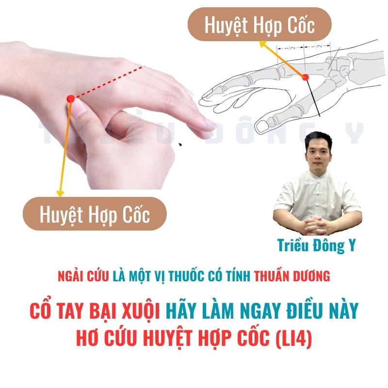 Giải Mã Chuyên Sâu: Tại Sao Hơ Cứu Huyệt Hợp Cốc (LI4) Lại Là "Chìa Khóa Vàng" Điều Trị Cổ Tay Bại Xuội?