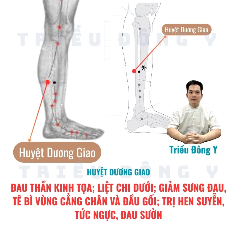 Huyệt Dương Giao 4 Tác Dụng Huyệt Dương Giao Đau thần kinh tọa; Liệt chi dưới; Giảm sưng đau, tê bì vùng cẳng chân và đầu gối; Trị hen suyễn, tức ngực, đau sườn