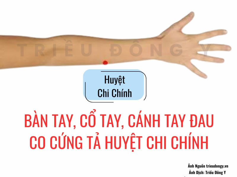 Bàn tay, cổ tay, cánh tay đau co cứng tả huyệt Chi Chính 2 Bàn tay, cổ tay, cánh tay đau co cứng tả huyệt Chi Chính