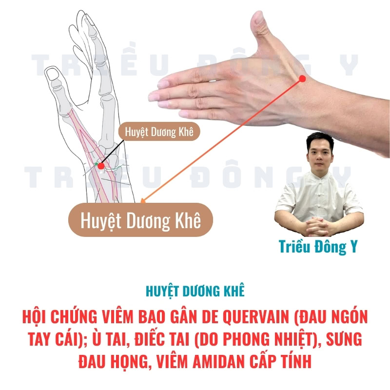 Huyệt Dương Khê 4 Tác dụng chúng của huyệt Dương Khê điều trị Hội chứng viêm bao gân De Quervain (Đau ngón tay cái); Ù tai, điếc tai (do phong nhiệt), sưng đau họng, viêm amidan cấp tính