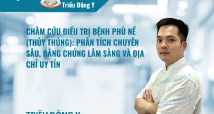 Địa chỉ châm cứu điều trị bệnh phù nề (thủy thủng) hiệu quả