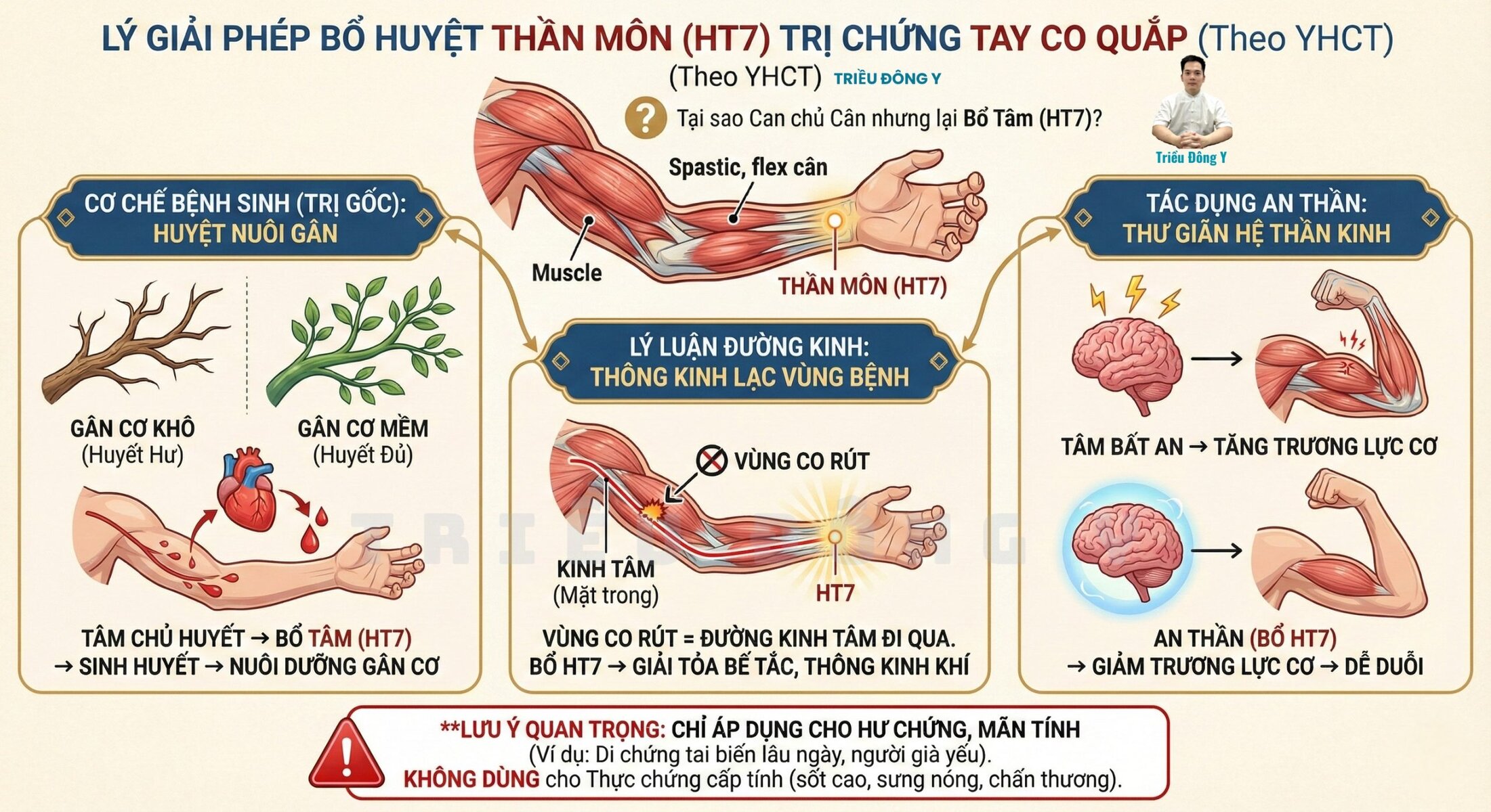 Huyệt Thần Môn 6 Giải mã bí ẩn vì sao tay, cánh tay co quắp lại bổ huyệt thần môn