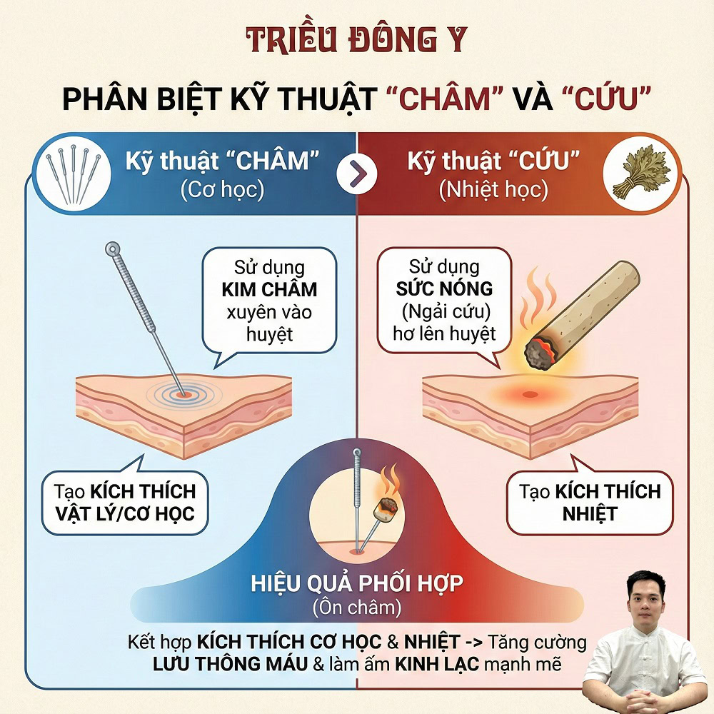 Phân biệt châm và cứu khác nhau như thế nào?