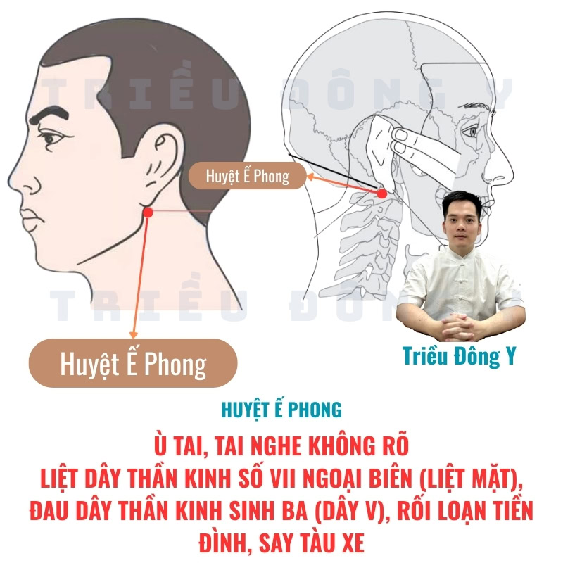 Khám phá huyệt Ế Phong (TE17) trong lâm sàng điều trị suy giảm thính lực và viêm tuyến mang tai