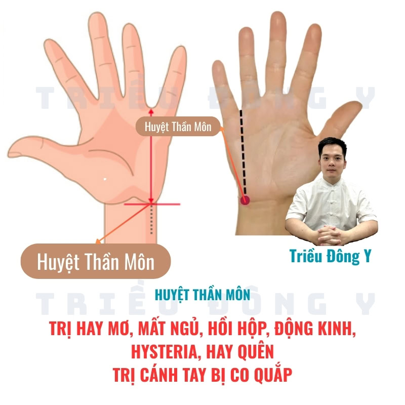 Huyệt Thần Môn 5 Tổng quan tác dụng chủ đạo của huyệt thân môn