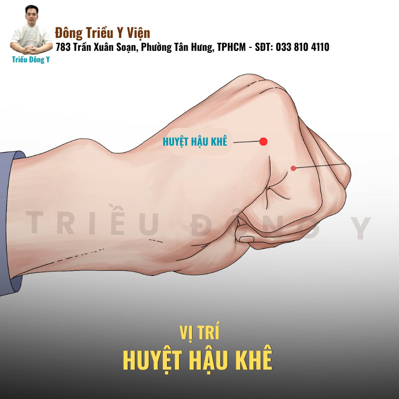 Huyệt Hậu Khê và Các Tác Dụng Đặc Hiệu