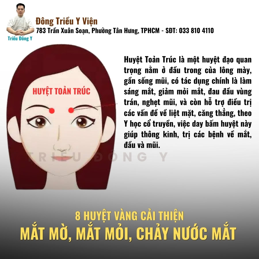Huyệt toan trúc huyệt vàng điều trị mờ mắt, nhức mắt, chảy nước mắt