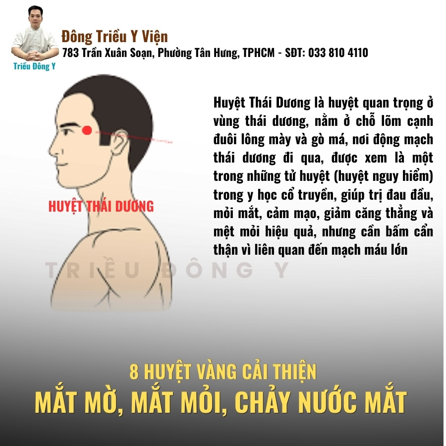 Huyệt thái dương huyệt vàng điều trị mờ mắt, nhức mắt, chảy nước mắt