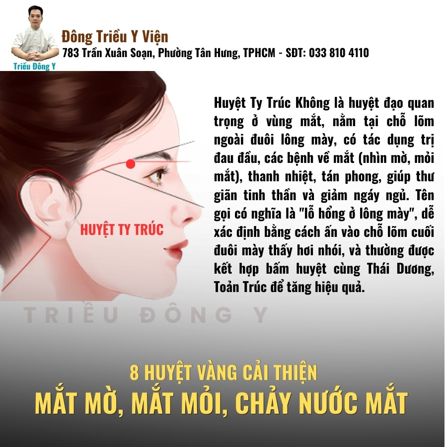 Huyệt ty trúc không huyệt vàng điều trị mờ mắt, nhức mắt, chảy nước mắt