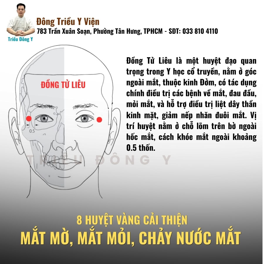 Huyệt đồng tử liêu huyệt vàng điều trị mờ mắt, nhức mắt, chảy nước mắt