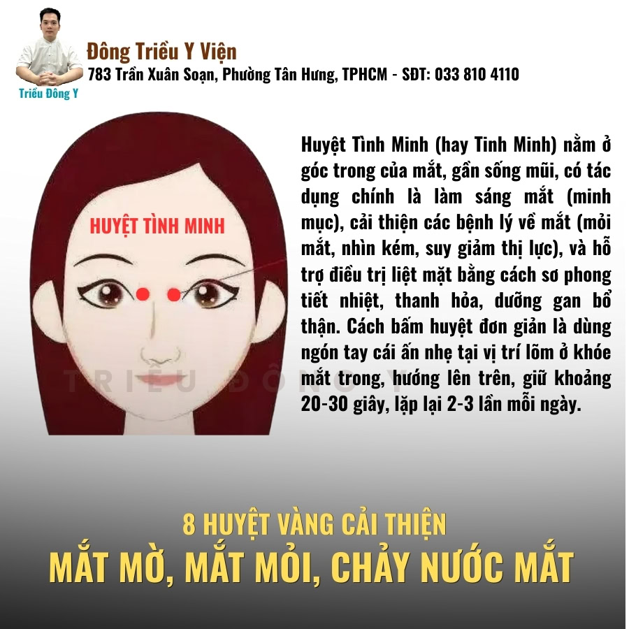 Huyệt tình minh huyệt vàng điều trị mờ mắt, nhức mắt, chảy nước mắt
