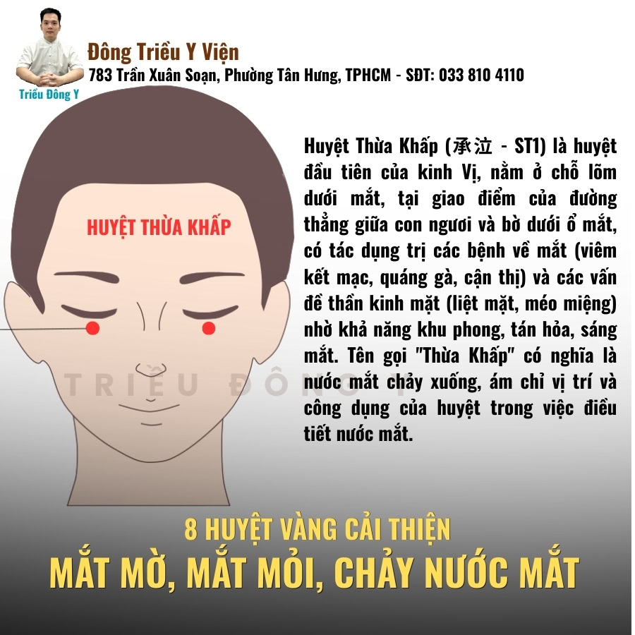 Huyệt thừa khấp huyệt vàng điều trị mờ mắt, nhức mắt, chảy nước mắt