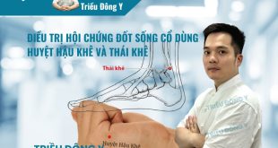 Điều Trị Hội Chứng Đốt Sống Cổ Dùng Huyệt Hậu Khê và Thái Khê