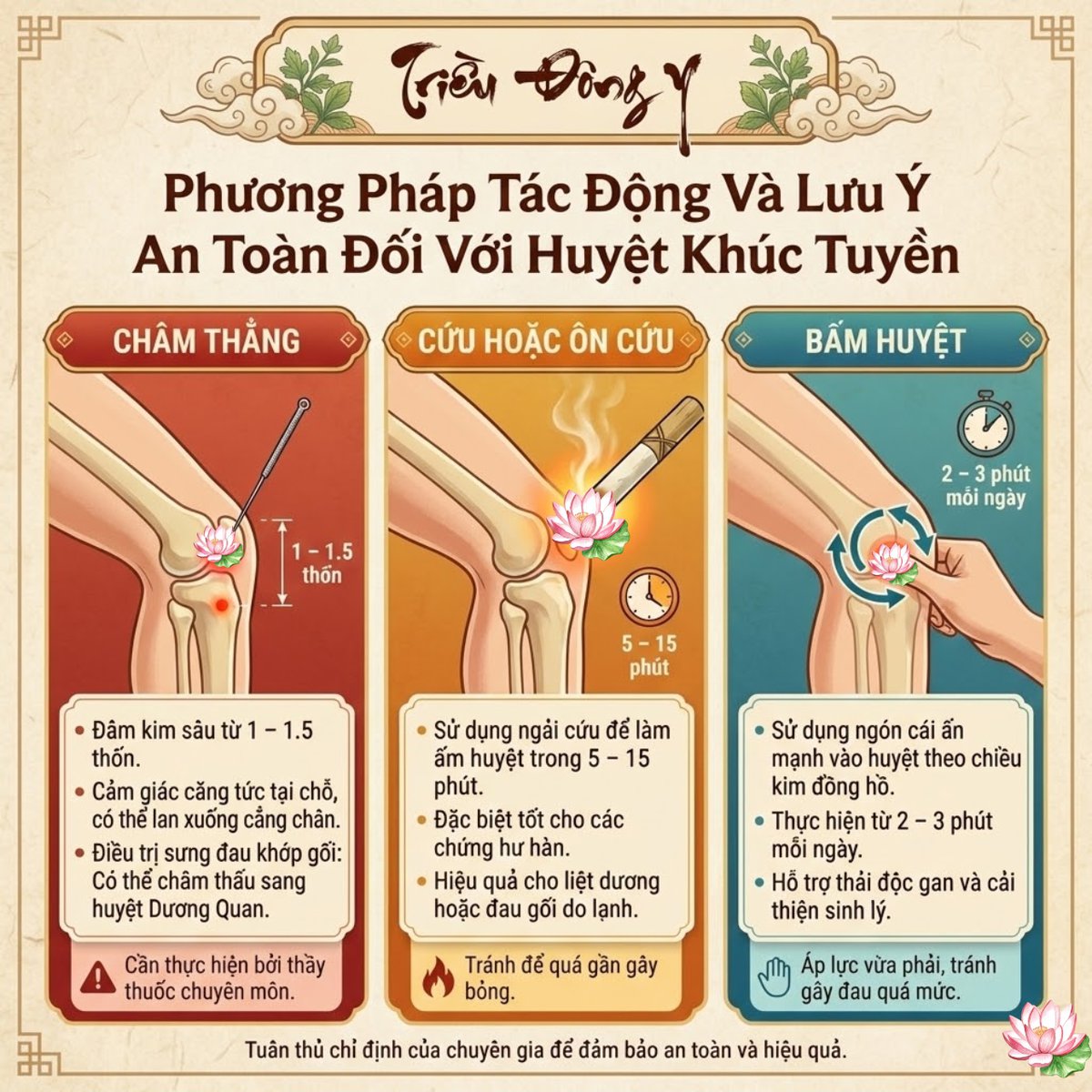 Sơ đồ phương pháp tác động đối với huyệt Khúc Tuyền