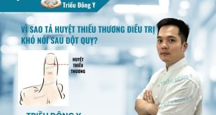 Vì sao tả huyệt Thiếu Thương trị khó nói sau đột quỵ? Đây là huyệt tỉnh thuộc kinh Phế, áp dụng tả pháp giúp thanh nhiệt, khai khiếu và thông lợi yết hầu.