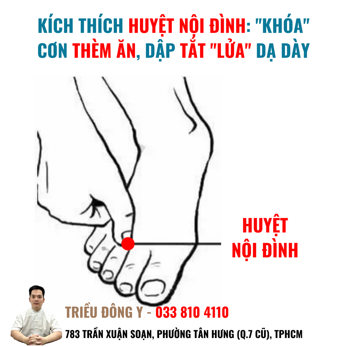 Huyệt Nội Đình là Huyệt Vinh thuộc hành Thủy, chuyên trị các chứng thực hỏa, đau răng, chảy máu cam