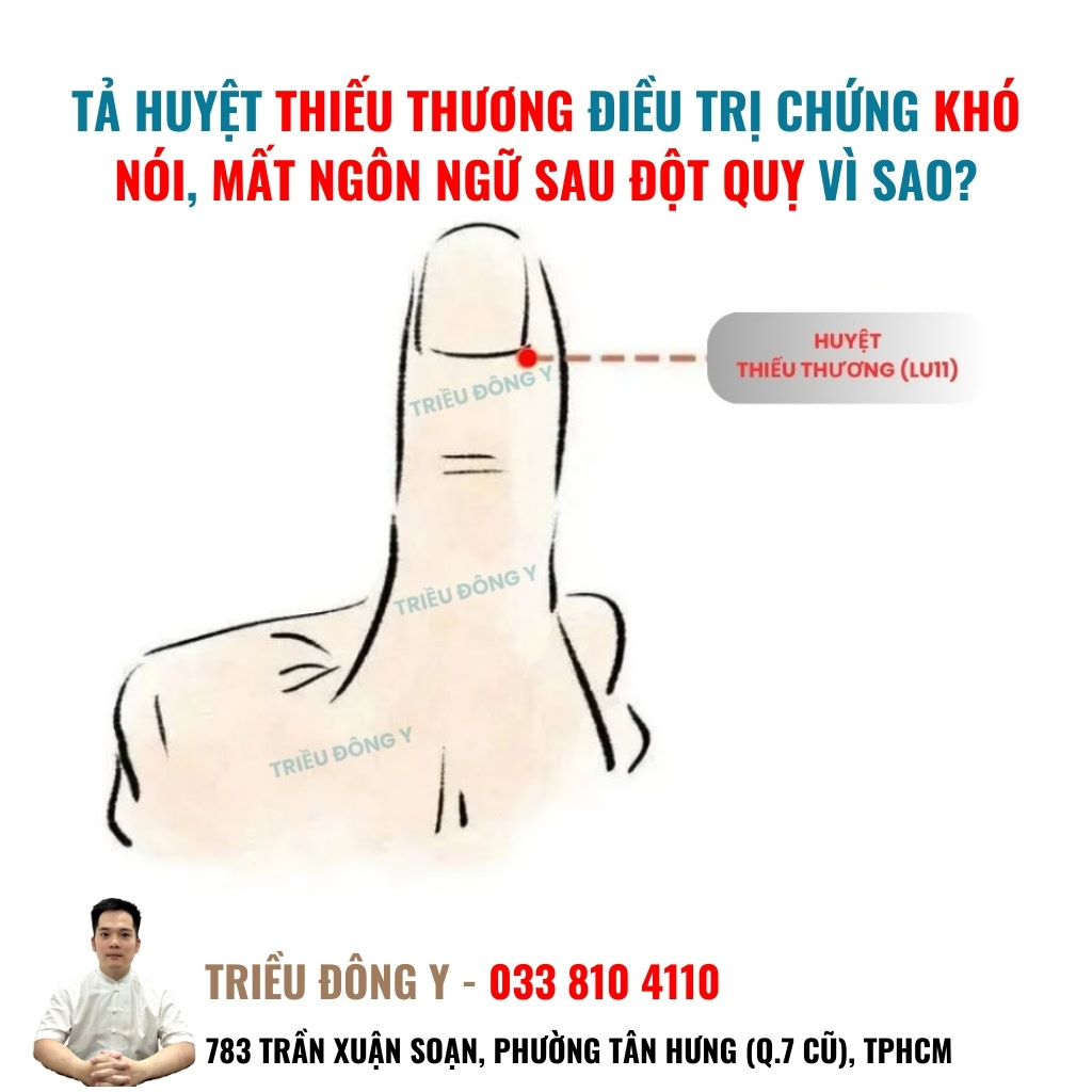 Giải mã cơ chế tả huyệt Thiếu Thương điều trị khó nói. Kỹ thuật giúp sơ phong giải biểu, điều hòa khí huyết và phục hồi rối loạn ngôn ngữ sau tai biến